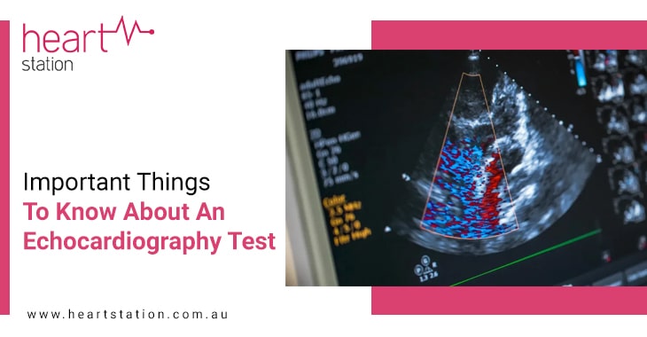Important Things To Know About An Echocardiography Test