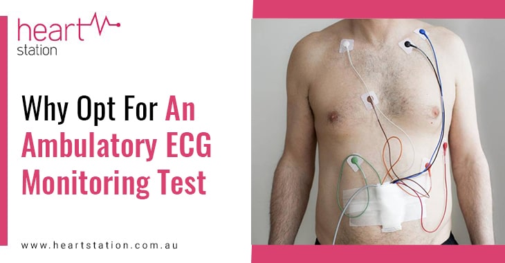 Why Opt For An Ambulatory ECG Monitoring Test