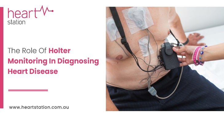 The Role Of Holter Monitoring In Diagnosing Heart Disease